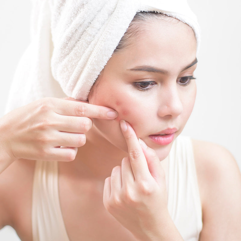 
  
    Acne Problem
  
  treatment products collection