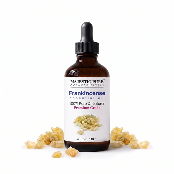 Frankincense Essential Oil | 100% Pure and Natural | 4 fl oz