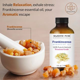 Frankincense Essential Oil (4oz)