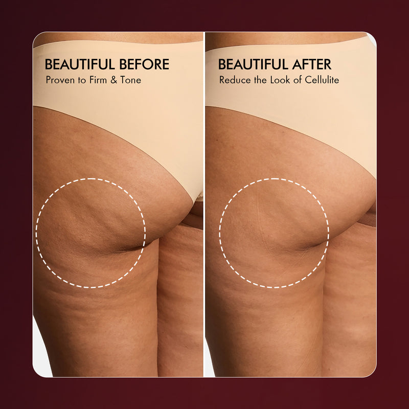 
  
    Anti Cellulite Body Firming Massage Oil
  
