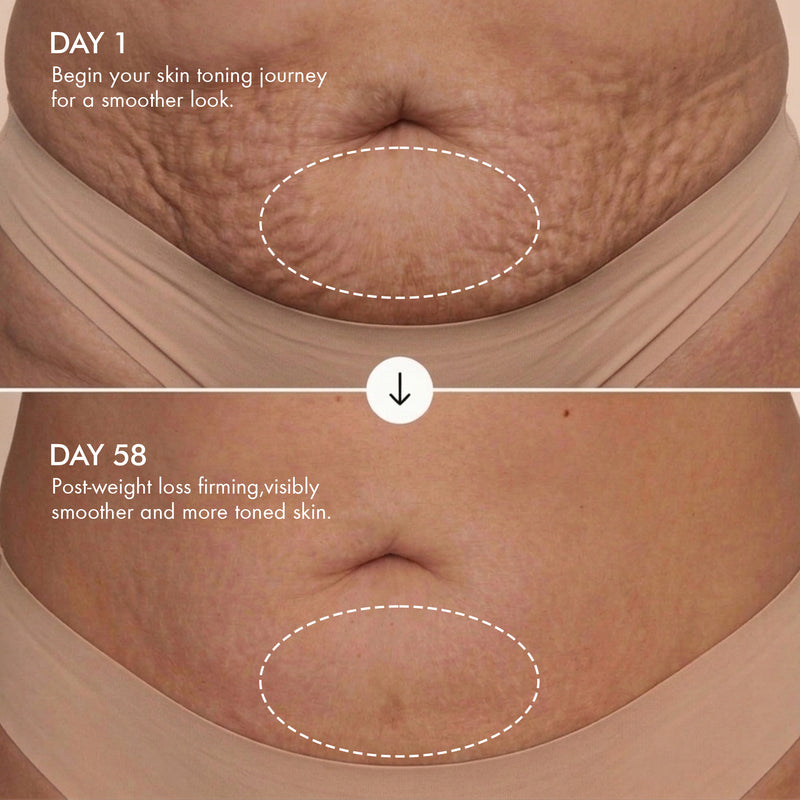 
  
    Anti Cellulite Body Firming Massage Oil
  
