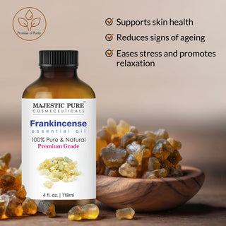 
  
    Frankincense Essential Oil | 100% Pure and Natural | 4 fl oz
  
