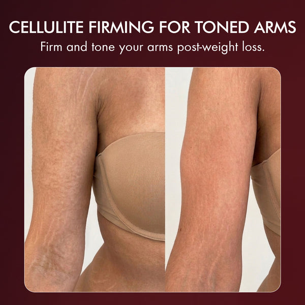 
  
    Anti-Cellulite Body Firming Massage Oil — Skin Toning and Elasticity Support — Majestic Pure
  
