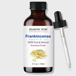 Frankincense Essential Oil (4oz)